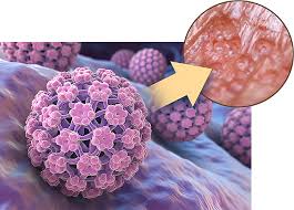 Human papillomavirus (HPV) is the name of a group of 200 known viruses.