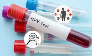 HPV and Cancer